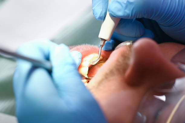 Best Walk-In Emergency Dental Services in East Newark, NJ