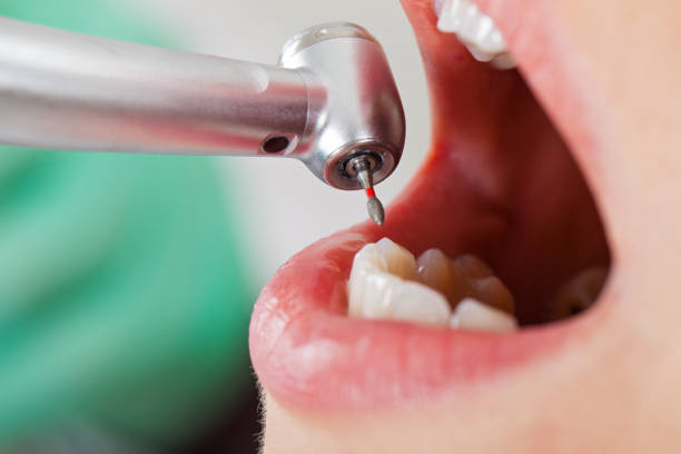 Best Emergency Denture Repair in East Newark, NJ